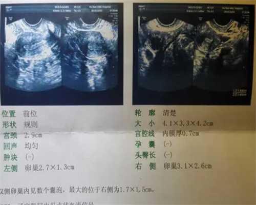 上海供卵私立医院,月经不调吃什么能来月经上海明珠医院