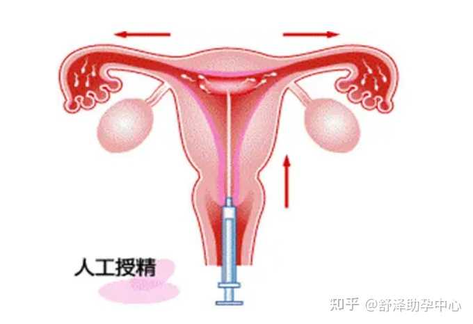 2023上海仁济医院可以做供卵试管婴儿吗?-代孕哪家价钱低